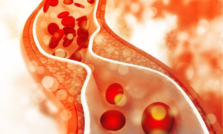 Bad Cholesterol થી મળશે છુટકારો : ગંદા કોલેસ્ટ્રોલનું કામ તમામ કરી નાંખશે આ ખાસ ચોખા